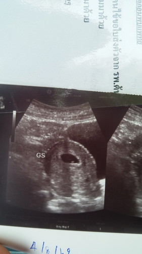 6W