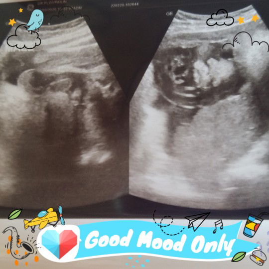 หวัดดีคับ ผม35W 4D