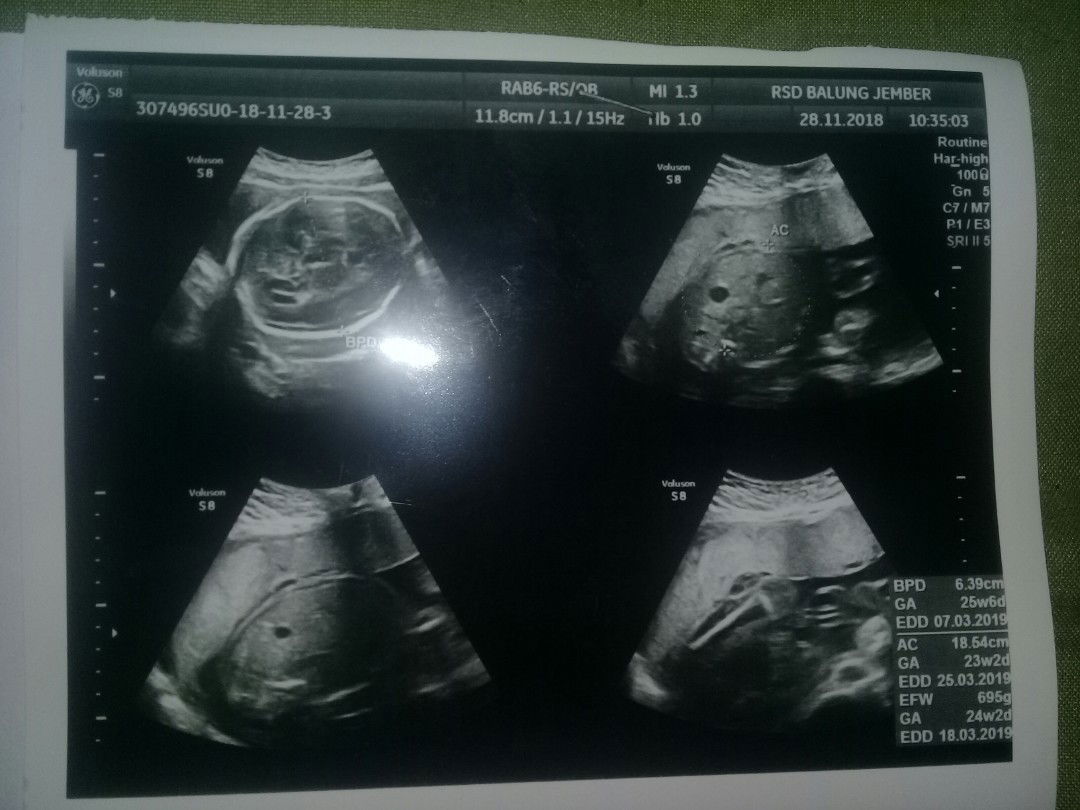 Siti Munawaroh profile icon