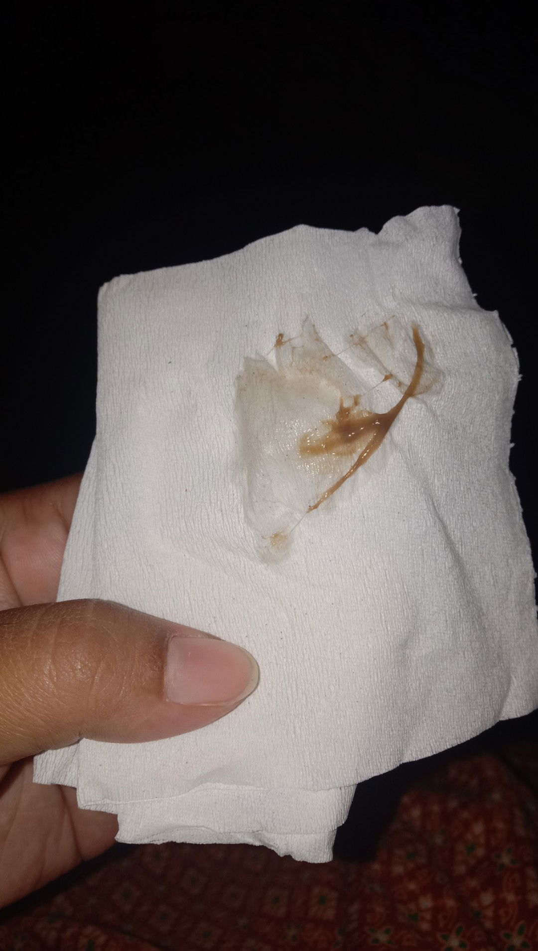 ทำไมเลือดเป็นสีน้ำตาลคะ