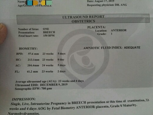 ultra sound