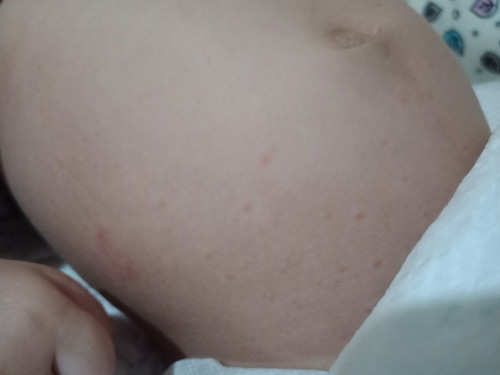 small red dots
