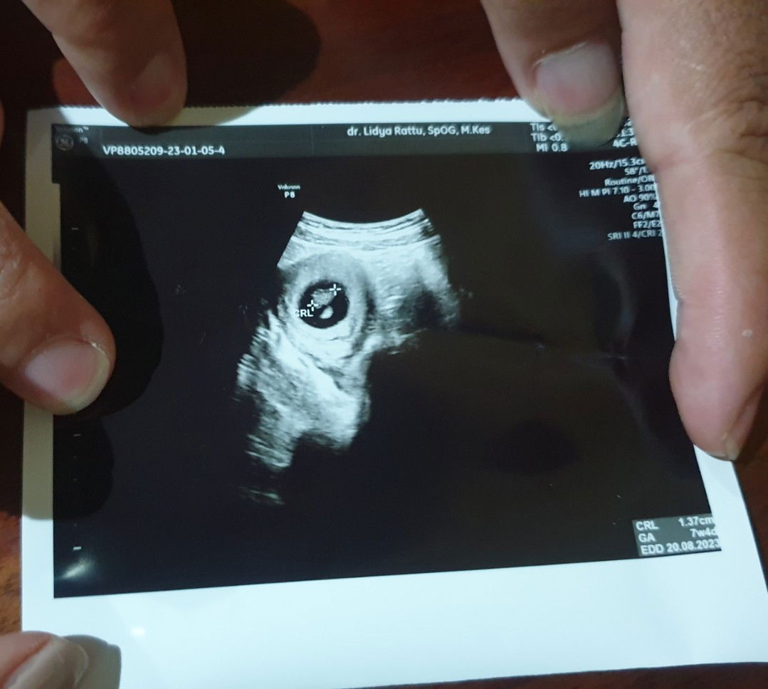 Christie Zullyvia profile icon