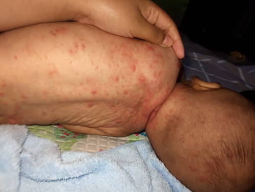 Bun mau tanya ini kenapa ya terus obat nya apa,,