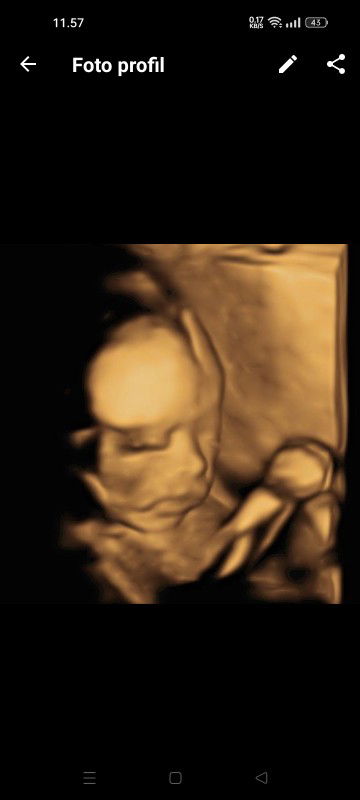 Regina Dwi Erlanda profile icon