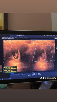 Creammie Nkt profile icon