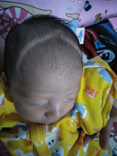 kepala bayi