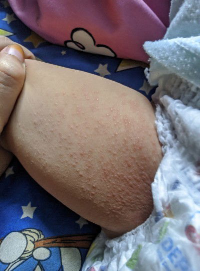 Minta solusinya bund