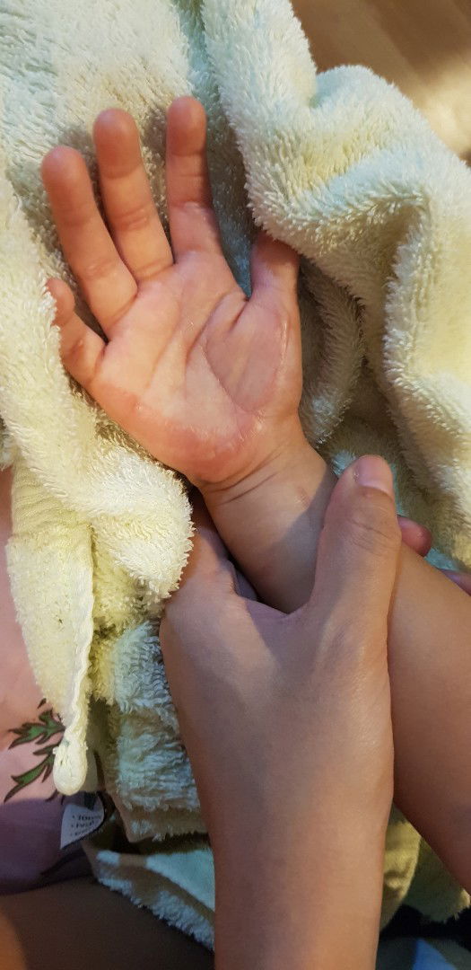 ขอเจ็บแทนลูกได้มั้ย