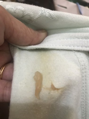 Mucus plug?