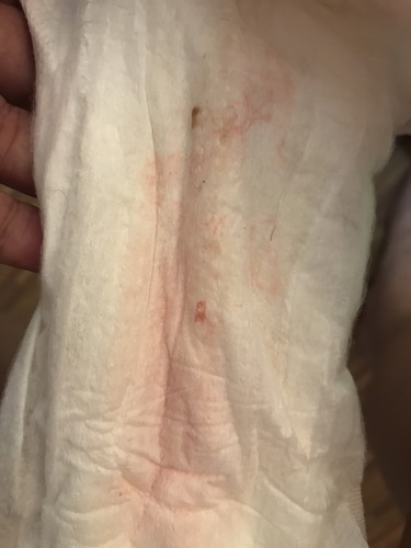 Discharge at 39 weeks