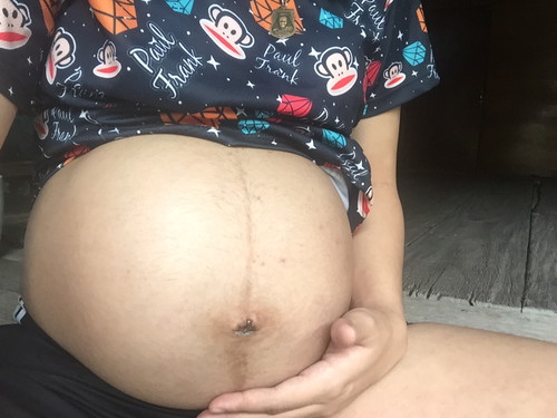 ท้องแบบนี้ผู้หญิงผู้ชายคะแม่ๆ