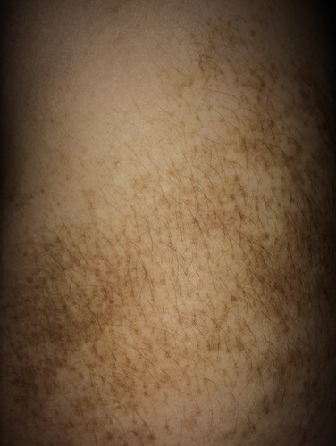 Tanda lahir atau bukan?