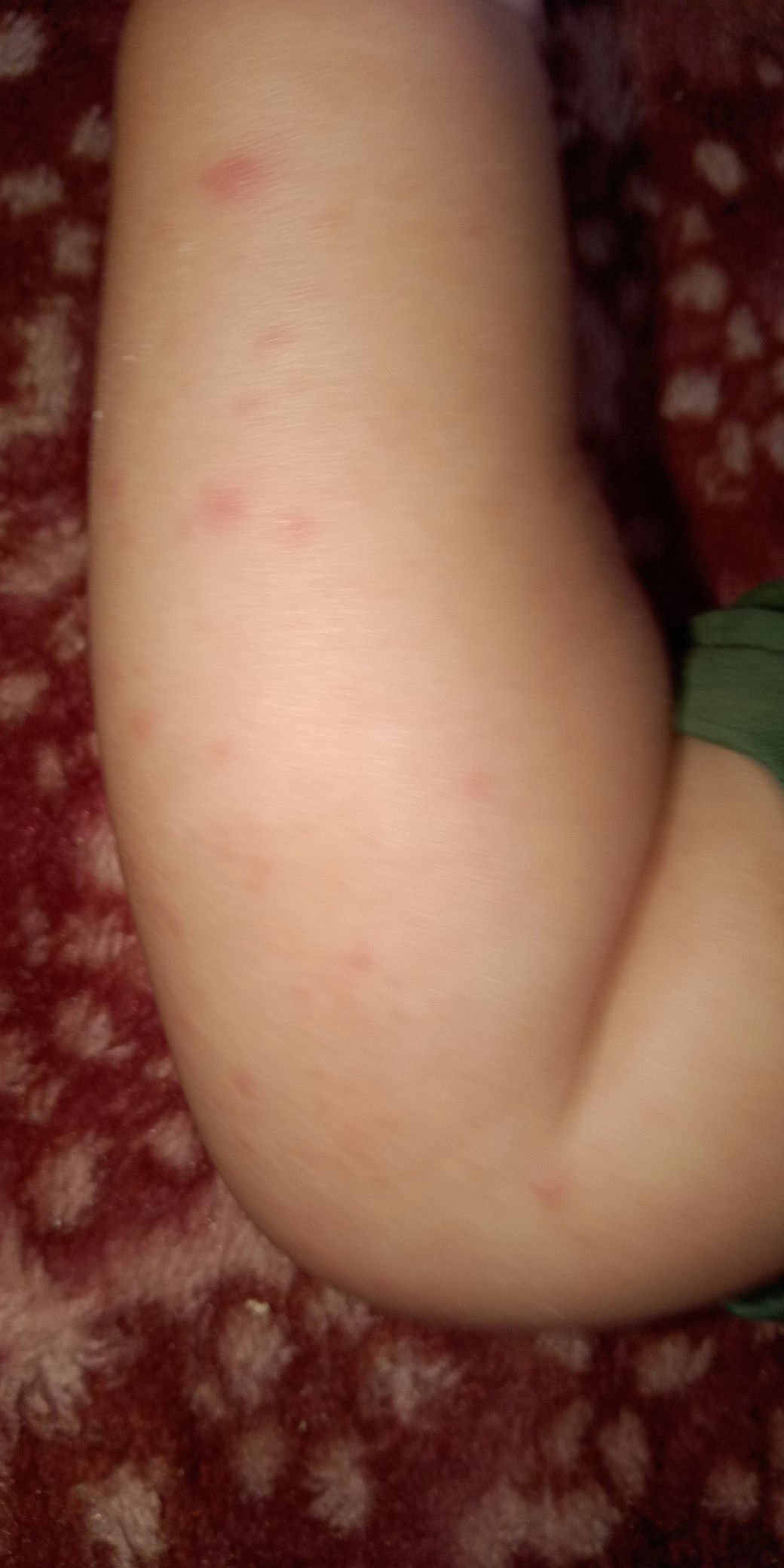 merah2 di kulit
