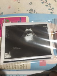 Wanna Srinual profile icon