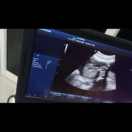 แม่ๆพอดูกันออกมั้ยคะว่า หญิงหรือชาย