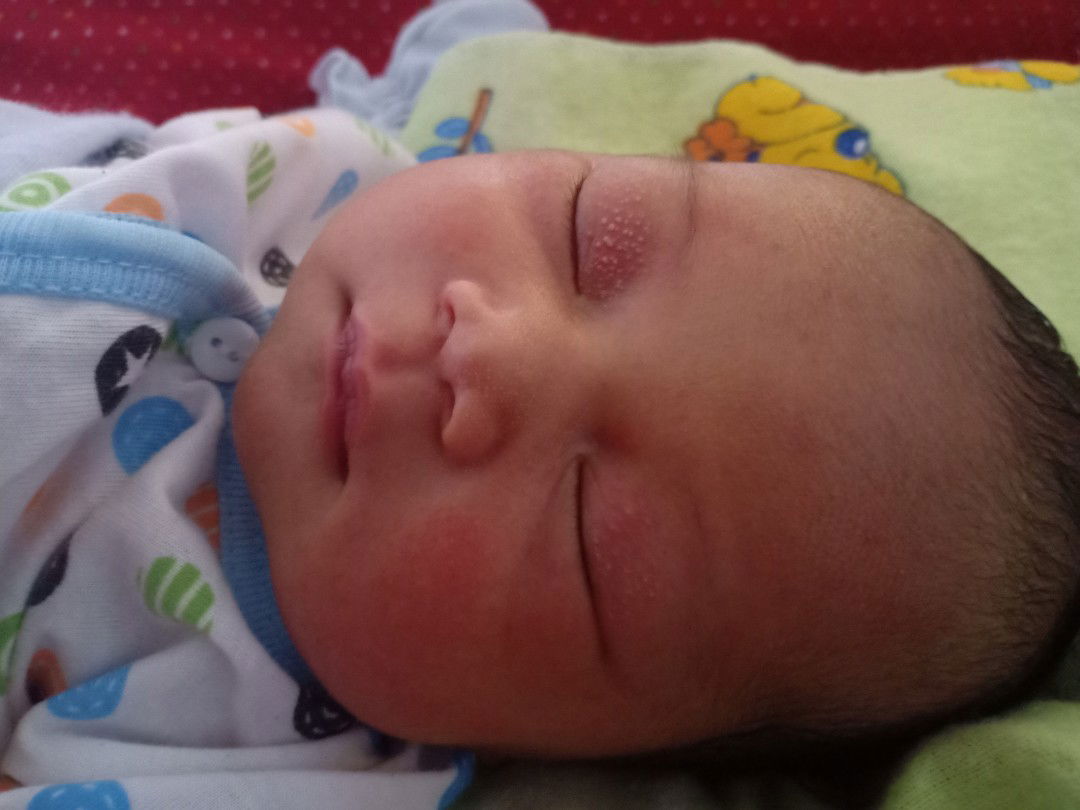 bintik putih dimata bayi