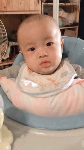 แชร์ประสบการณ์ผ่าคลอด