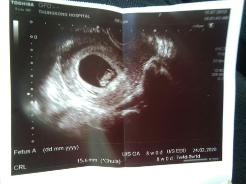 ฝากครรภ์??