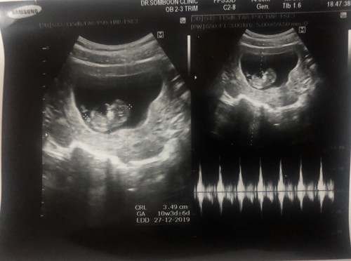 10 Weeks