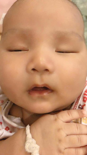 ลูกตัวเย็นมากแต่มีเหงื่อยออกตามมือกับเท้า อยากรู้ว่าเค้าจะเป็นไรไหมค่ะ