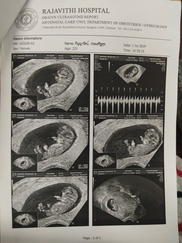 10w+5d #อยากเจอแล้ว ✨