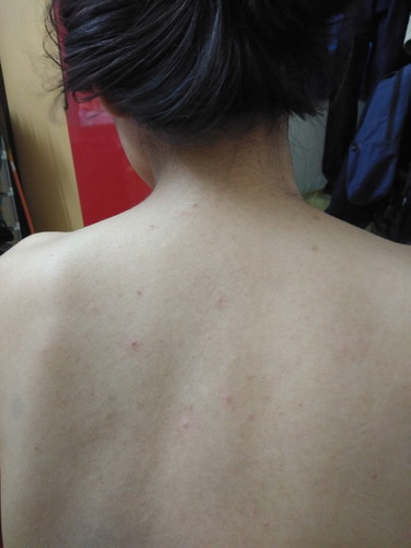 ใครเป็นบ้างคะ ใช้อะไรบำรุงรักษากันเอ่ย