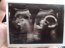 Supaporn  Watthanatiti profile icon