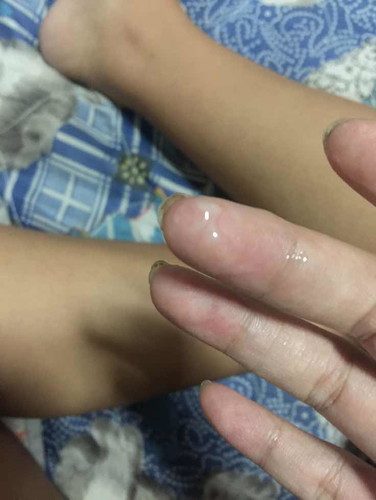เเบบนี้ใช่มูลใสหรือป่าวค่ะ