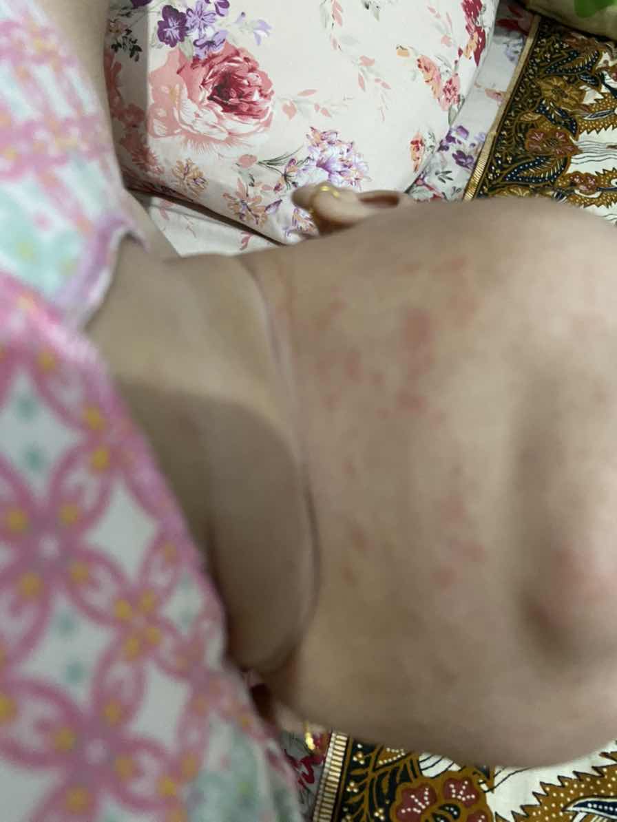 Bintik2 merah di bawah dagu