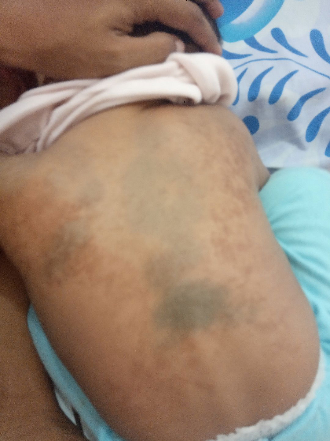 yg coklat ² itu knp ya bun