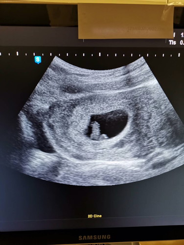 7 วีค 2 วันค่ะ