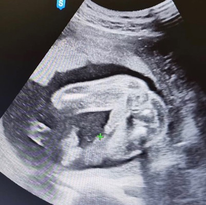 เพศชายจ้า