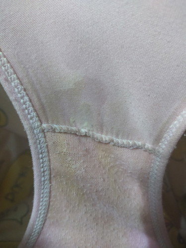 มูกใสหรือตกขาว