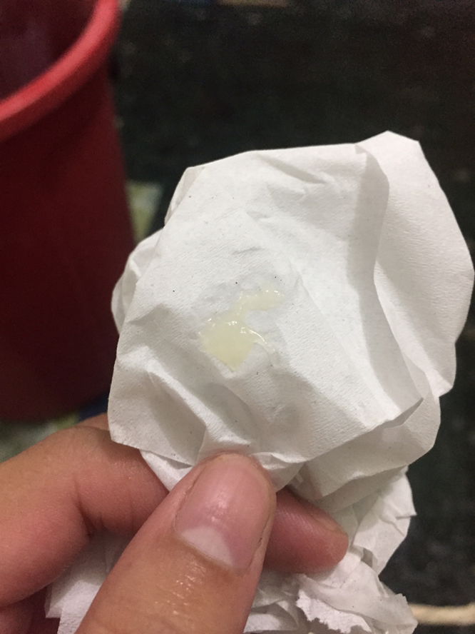 มีมูกใส2 วัน อายุครรภ์ 37+3