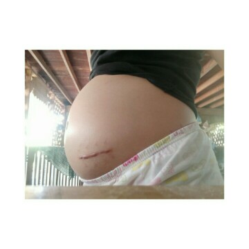 ท้องใหญ่ไปไหมคะ 26week ?