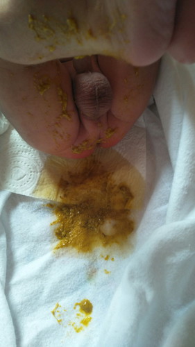 ลูก1เดือน2วัน