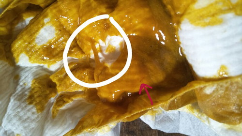 น้อง1เดือน26วันเป็นลำไส้อักเสบ ถ่ายมีมูกปนเศษเลือด