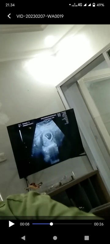 Tasma Wati28 profile icon