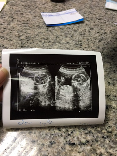 อยากทราบว่า ญ หรือ ช ค่ะ 17wแล้วค่ะ