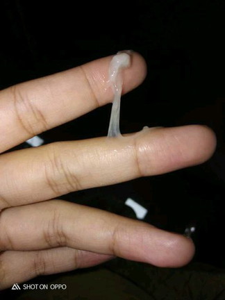 เป็นเเบบนี้อันตรายไหมคะ?