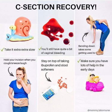 C-Section