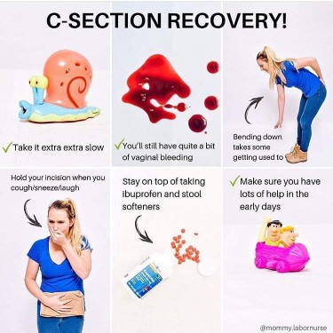 C-Section