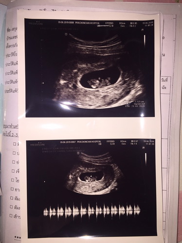 นน. เจ้าตัวน้อยดูจากตรงไหน