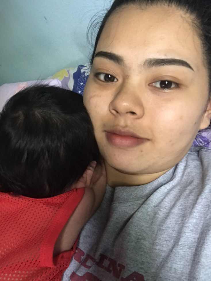 โกนผมไฟ