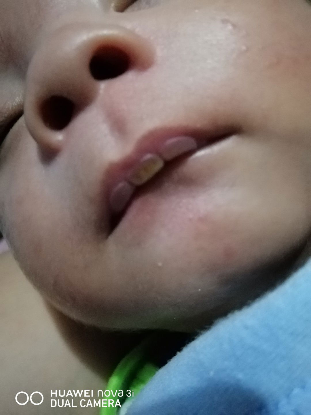 Nipple For Feeding Bottle