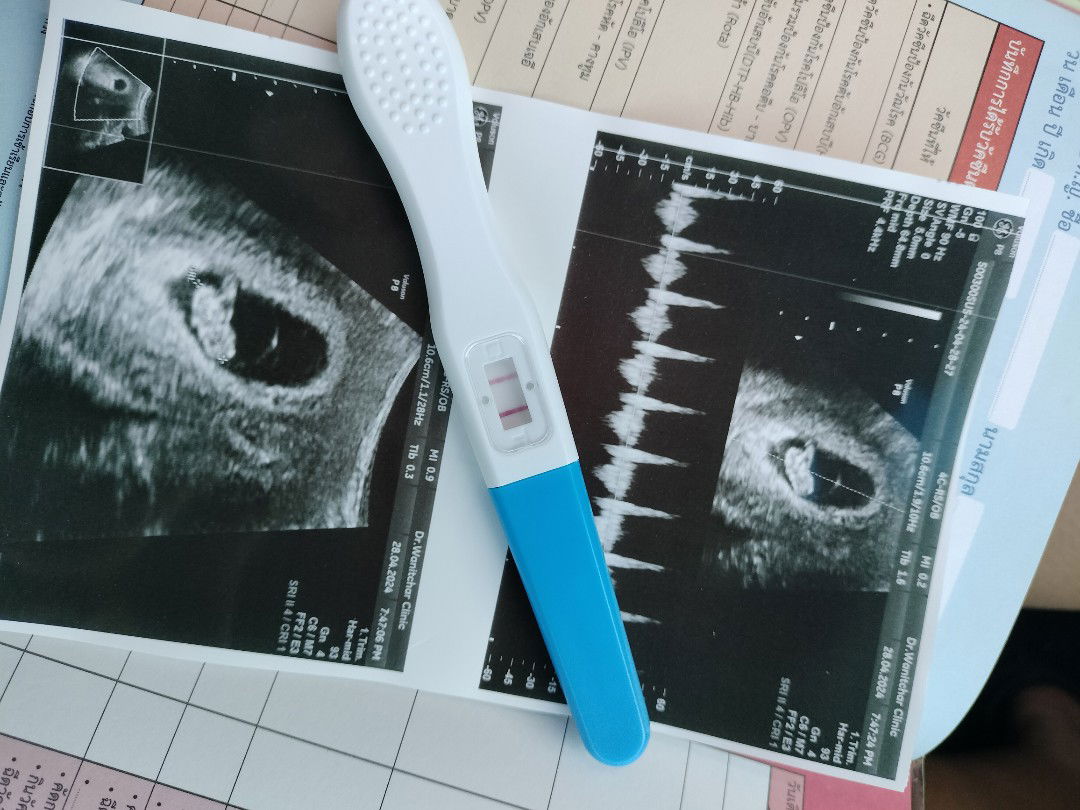 รัชนงค์ ราชดำเนิน profile icon