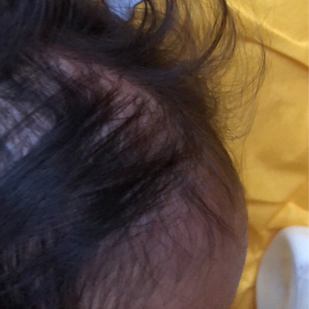 Atas Dari ubun merah dan bengkak