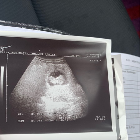 Baby first