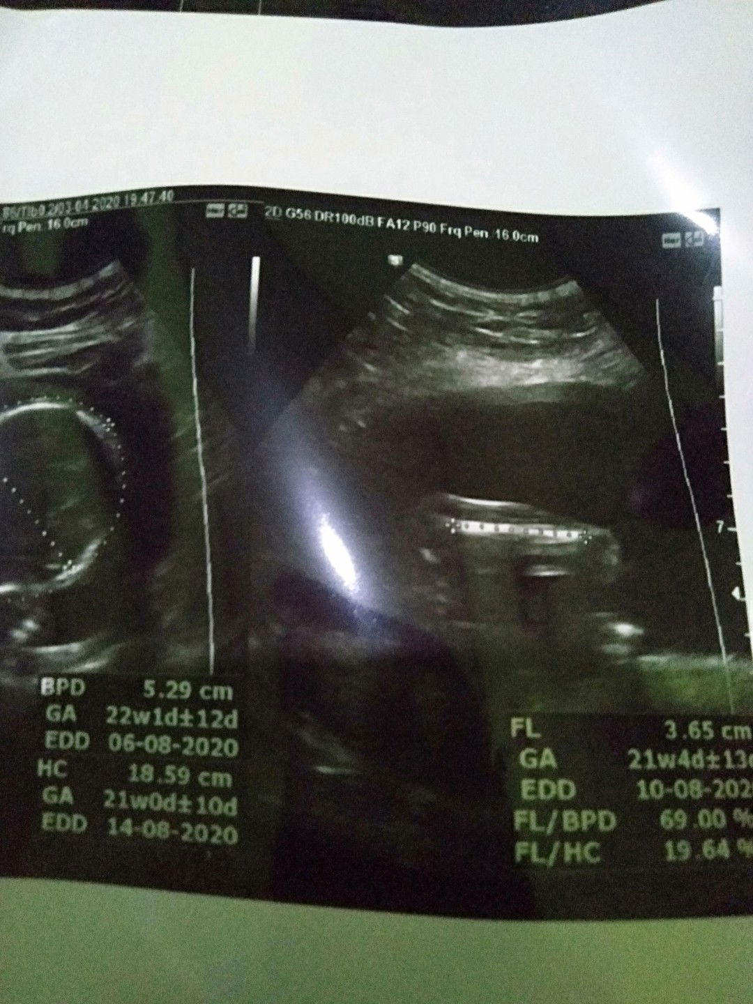 cara baca usia kandngn menurut usg